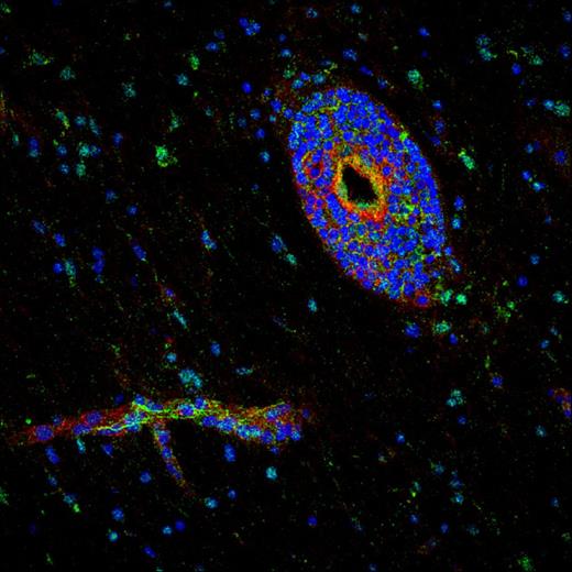 Layers of fluorescent blue and green cells surrounding a hollow blood vessel