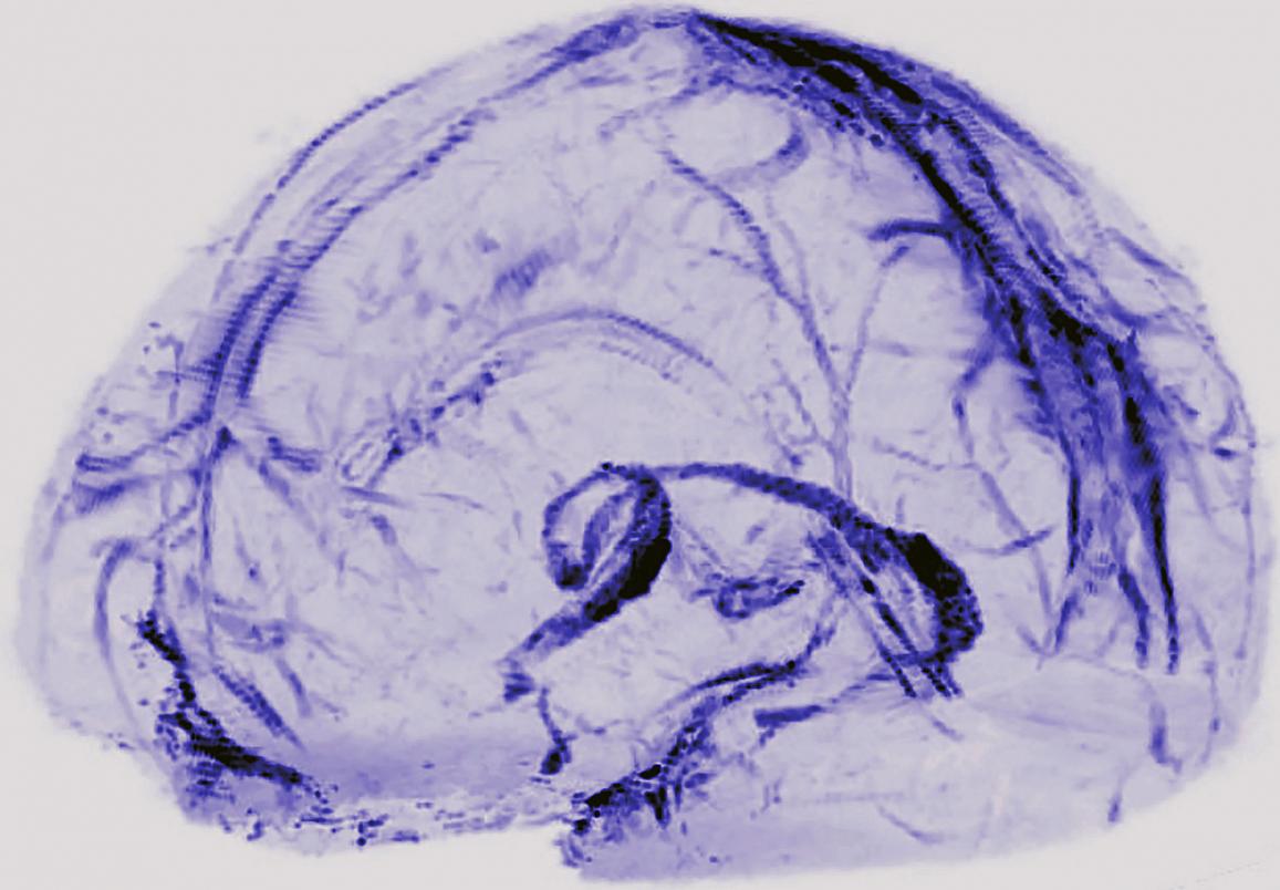 Blue branching structures outlining the shape of a brain