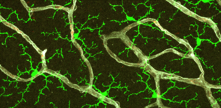 Neon green cells with branching networks emerging from them