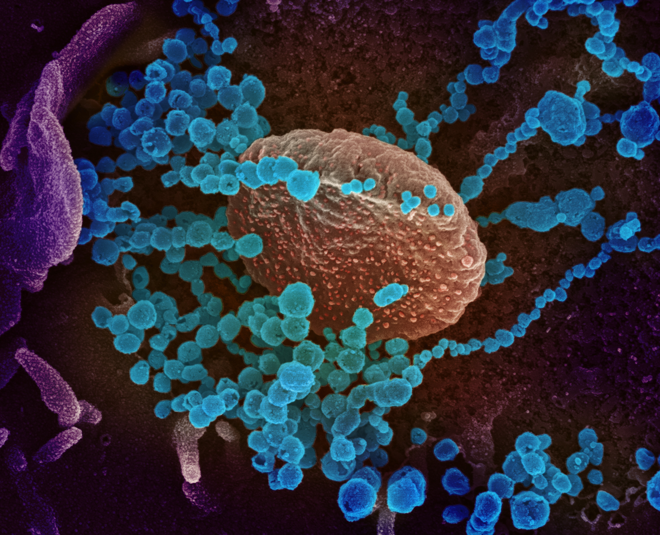 SARS-CoV-2 particles emerging from infected cells